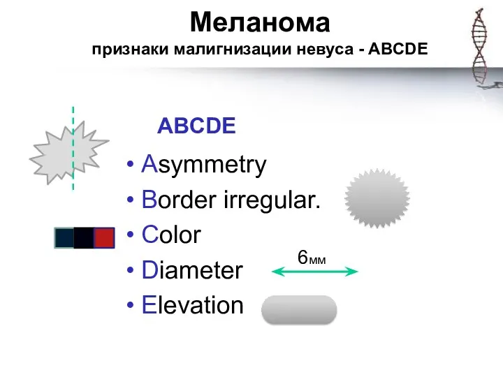 Меланома признаки малигнизации невуса - ABCDE ABCDE Asymmetry Border irregular. Color Diameter Elevation 6мм