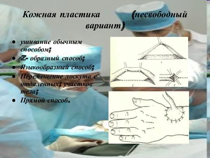 Кожная пластика (несвободный вариант) ушивание обычным способом; Z- образный способ;