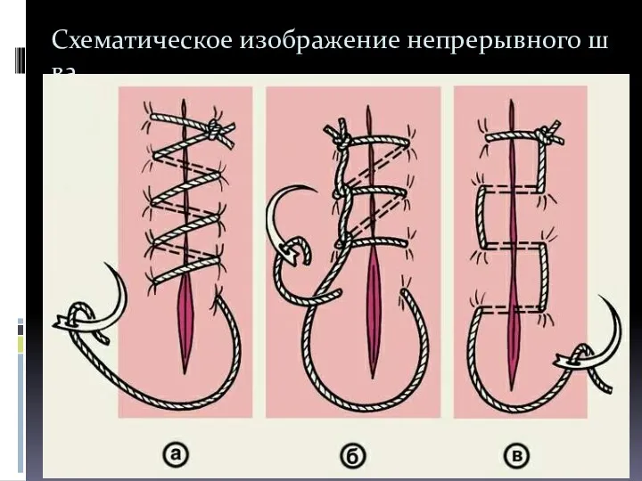 Схематическое изображение непрерывного шва.