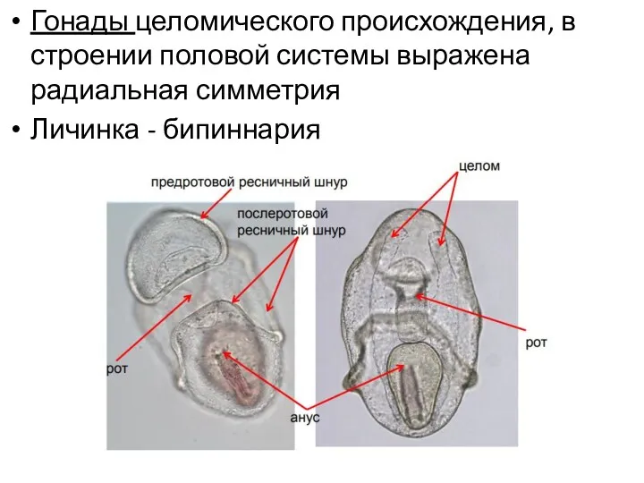 Гонады целомического происхождения, в строении половой системы выражена радиальная симметрия Личинка - бипиннария