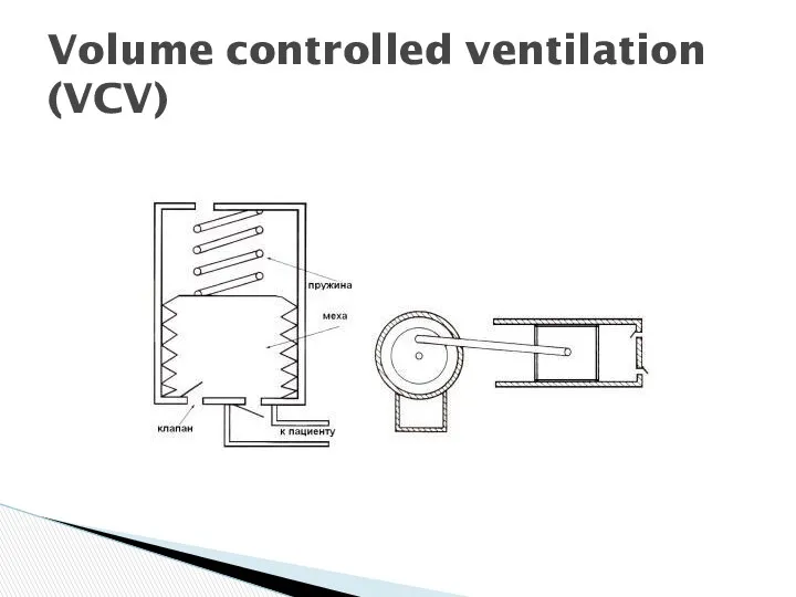 Volume controlled ventilation (VCV)