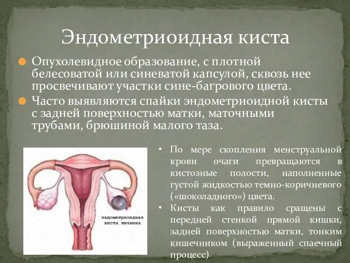 Опухолевидное образование, с плотной белесоватой или синеватой капсулой, сквозь нее