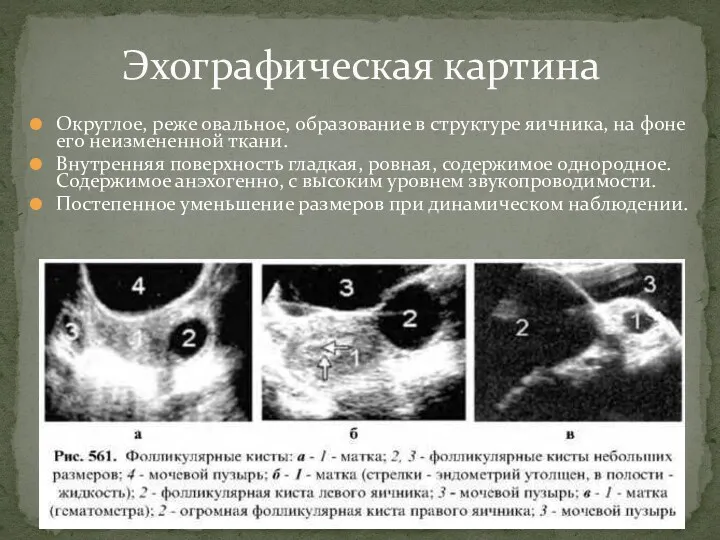 Округлое, реже овальное, образование в структуре яичника, на фоне его