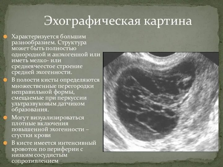 Характеризуется большим разнообразием. Структура может быть полностью однородной и анэхогенной