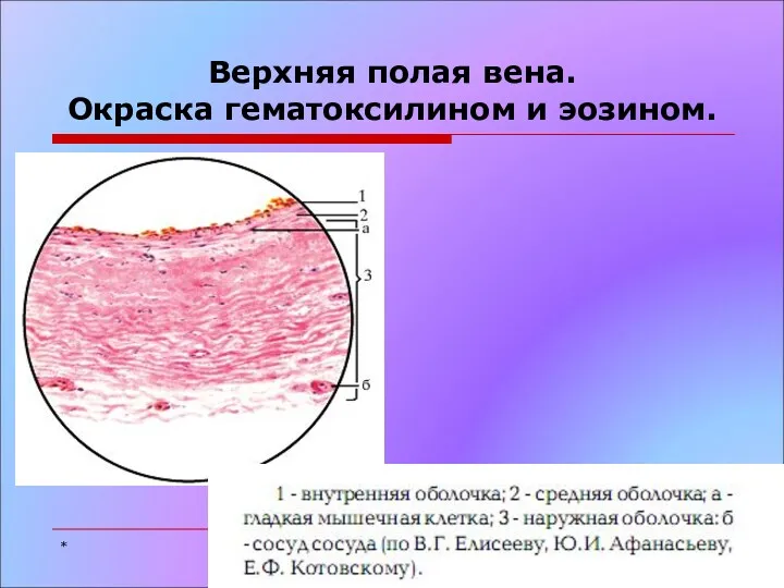 Верхняя полая вена. Окраска гематоксилином и эозином. *