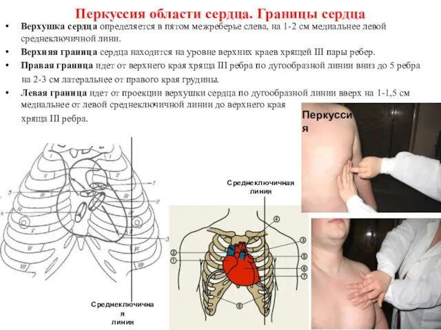 Перкуссия области сердца. Границы сердца Верхушка сердца определяется в пятом межреберье слева, на