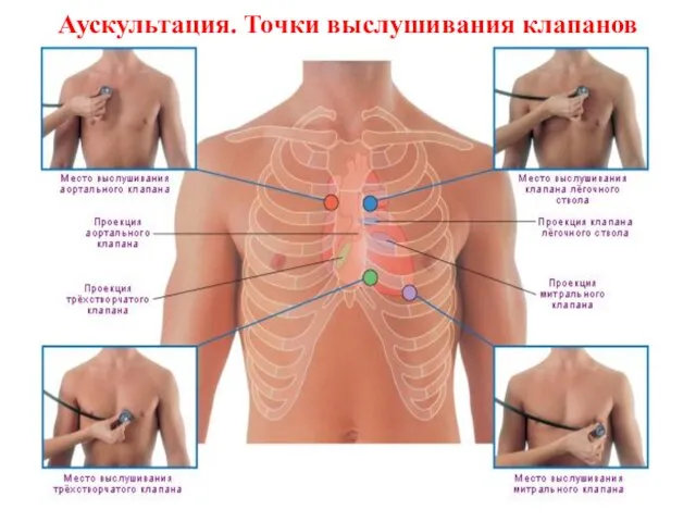 Аускультация. Точки выслушивания клапанов