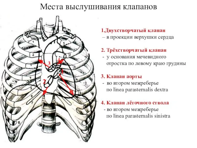 Места выслушивания клапанов 1.Двухстворчатый клапан – в проекции верхушки сердца