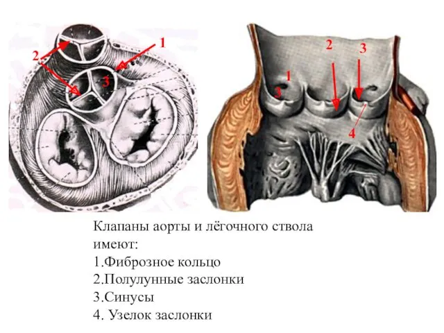 Клапаны аорты и лёгочного ствола имеют: 1.Фиброзное кольцо 2.Полулунные заслонки