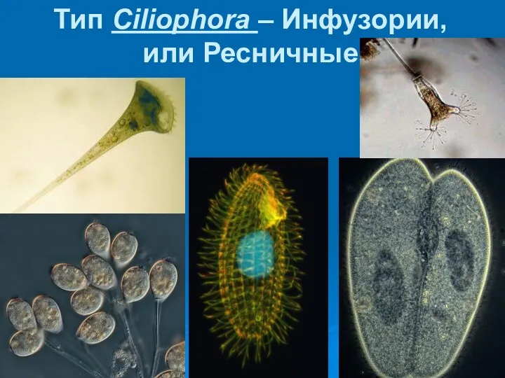 Тип Ciliophora – Инфузории, или Ресничные