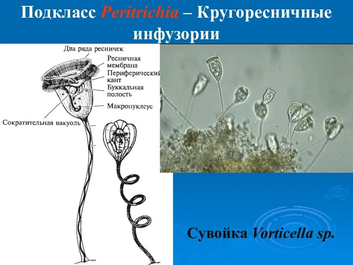 Подкласс Peritrichia – Кругоресничные инфузории Сувойка Vorticella sp.
