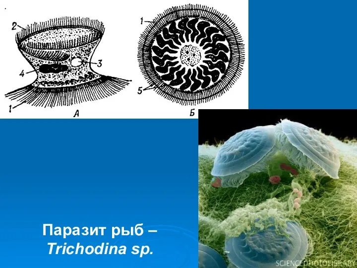 Паразит рыб – Trichodina sp.