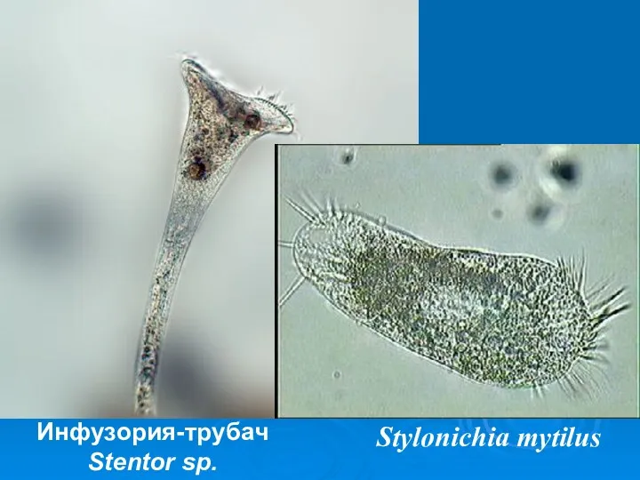 Инфузория-трубач Stentor sp. Stylonichia mytilus