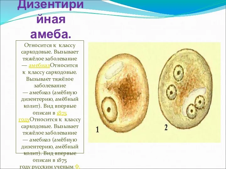 Дизентирийная амеба. Относится к классу саркодовые. Вызывает тяжёлое заболевание —