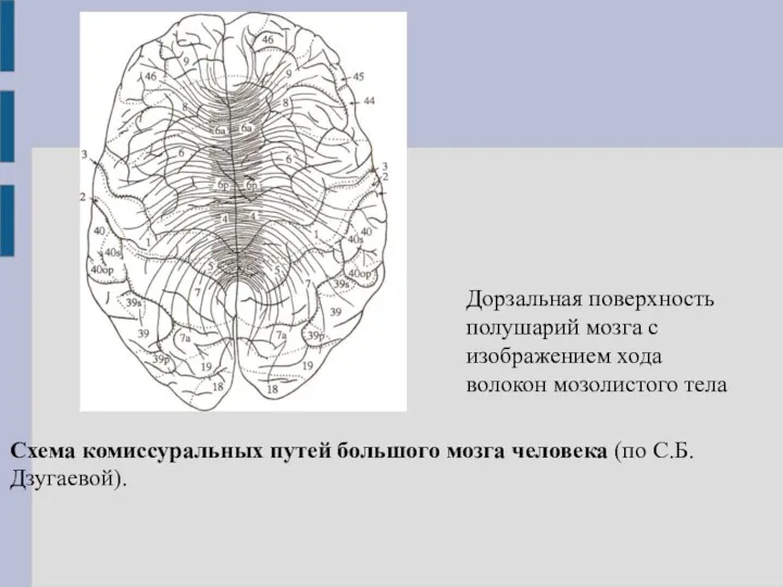 Дорзальная поверхность полушарий мозга с изображением хода волокон мозолистого тела
