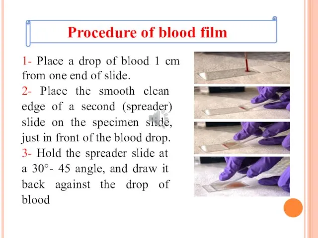 1- Place a drop of blood 1 cm from one