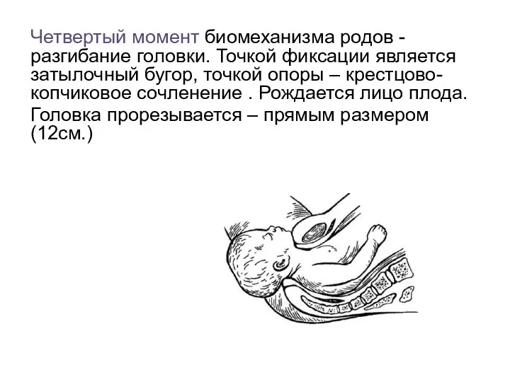 Четвертый момент биомеханизма родов - разгибание головки. Точкой фиксации является