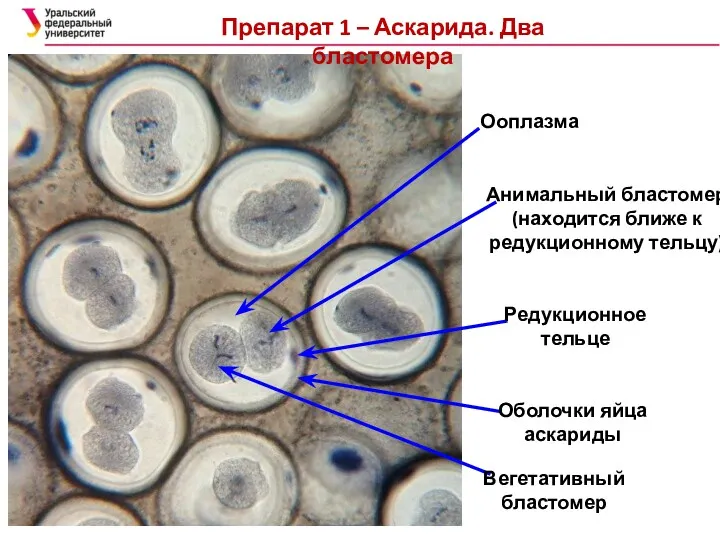 Препарат 1 – Аскарида. Два бластомера Ооплазма Анимальный бластомер (находится