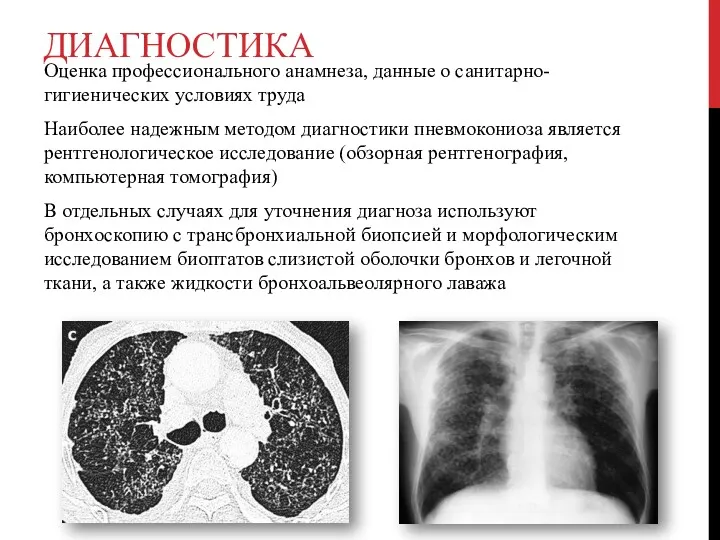 ДИАГНОСТИКА Оценка профессионального анамнеза, данные о санитарно-гигиенических условиях труда Наиболее надежным методом диагностики