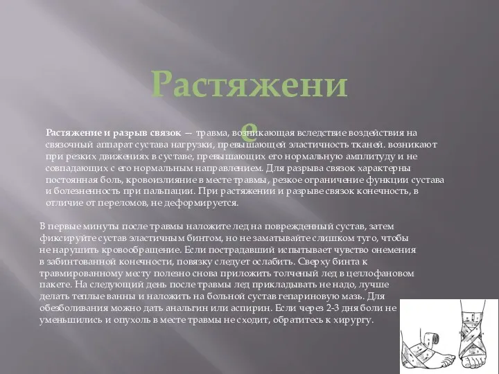 Растяжение Растяжение и разрыв связок — травма, возникающая вследствие воздействия