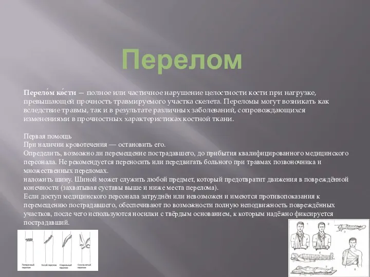 Перелом Перело́м ко́сти — полное или частичное нарушение целостности кости