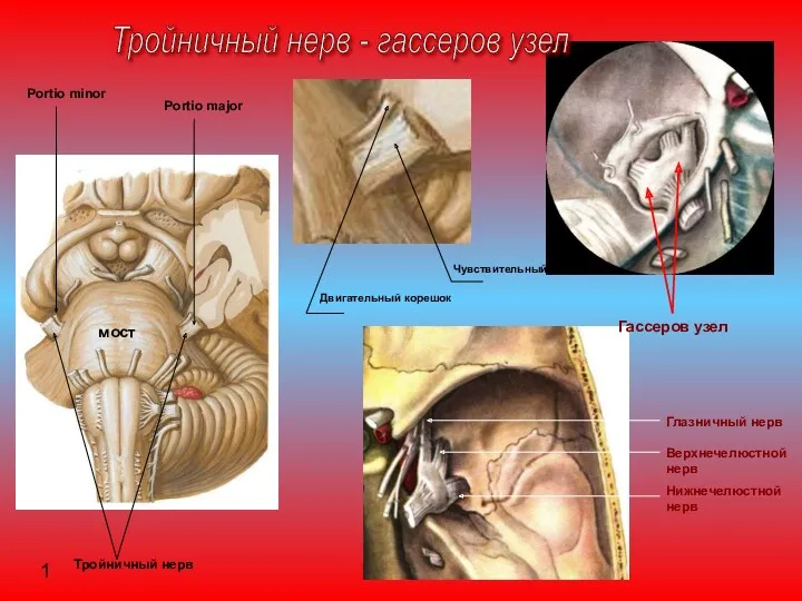 Тройничный нерв - гассеров узел Глазничный нерв Верхнечелюстной нерв Нижнечелюстной нерв Гассеров узел