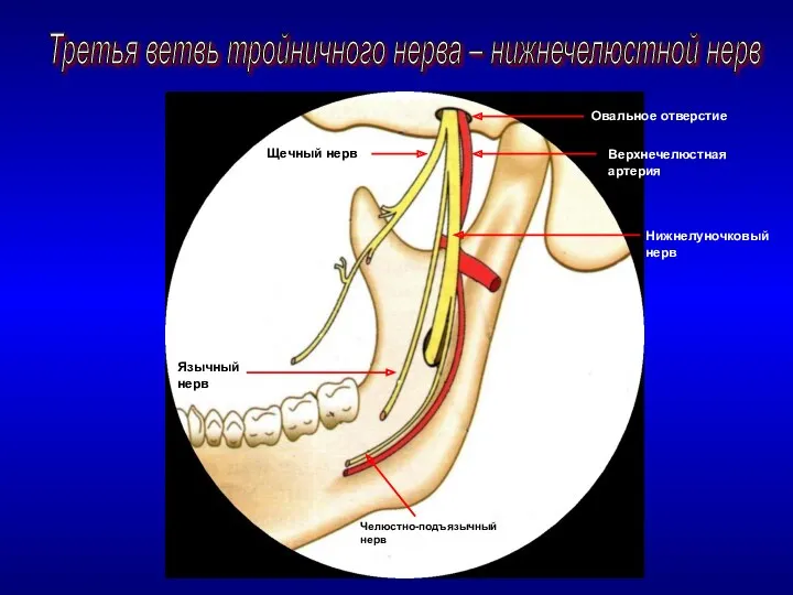 Третья ветвь тройничного нерва – нижнечелюстной нерв Овальное отверстие Щечный нерв Верхнечелюстная артерия