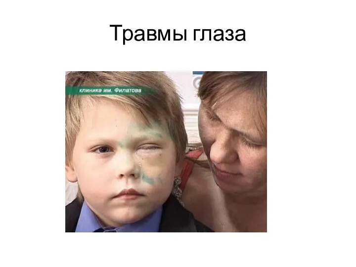 Травмы глаза