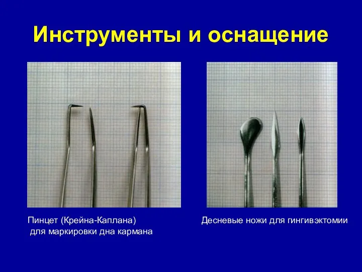 Инструменты и оснащение Пинцет (Крейна-Каплана) для маркировки дна кармана Десневые ножи для гингивэктомии