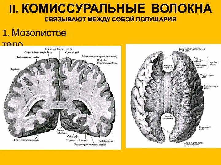 II. КОМИССУРАЛЬНЫЕ ВОЛОКНА СВЯЗЫВАЮТ МЕЖДУ СОБОЙ ПОЛУШАРИЯ 1. Мозолистое тело