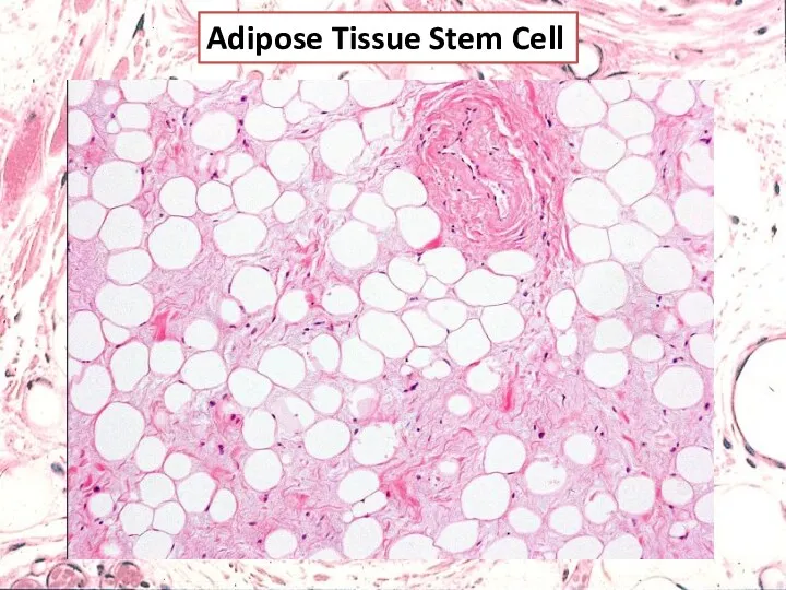 Adipose Tissue Stem Cell