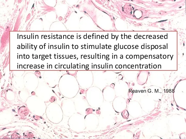 Insulin resistance is defined by the decreased ability of insulin