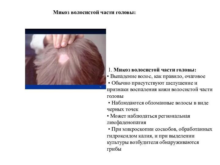 Микоз волосистой части головы: 1. Микоз волосистой части головы: •