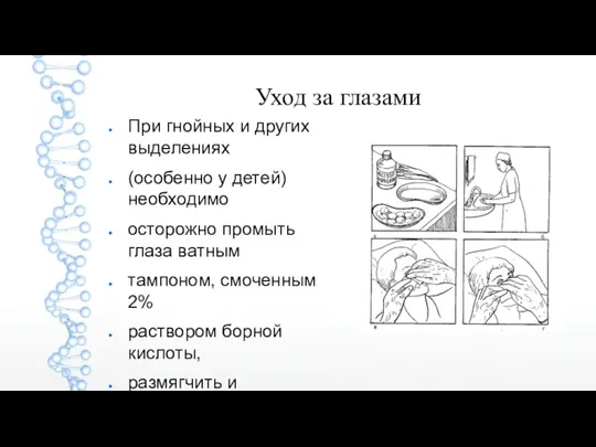 Уход за глазами При гнойных и других выделениях (особенно у