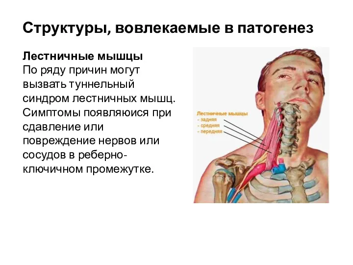 Структуры, вовлекаемые в патогенез Лестничные мышцы По ряду причин могут