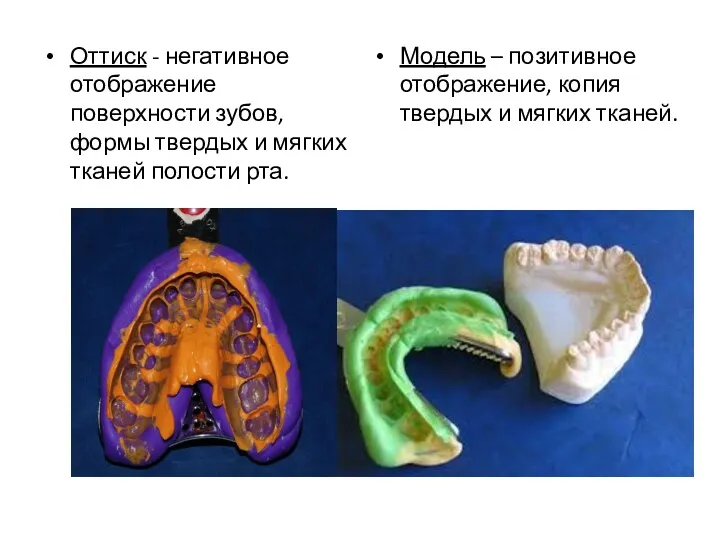 Оттиск - негативное отображение поверхности зубов, формы твердых и мягких