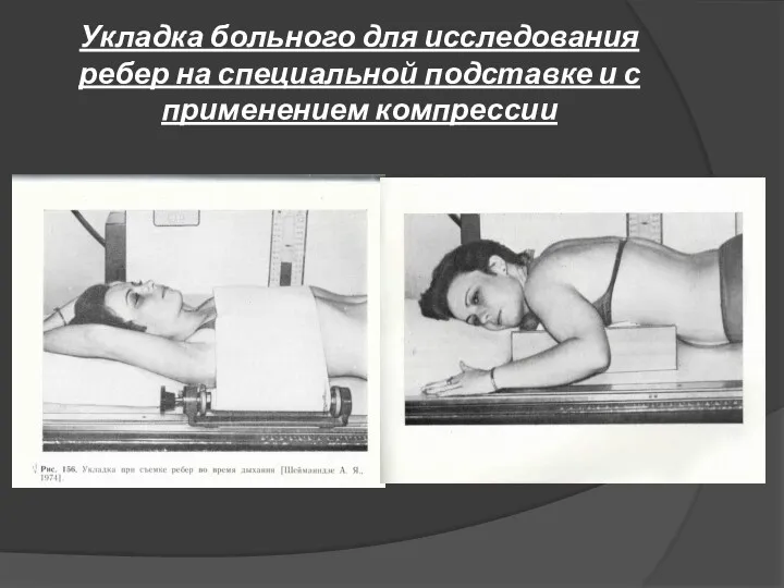 Укладка больного для исследования ребер на специальной подставке и с применением компрессии