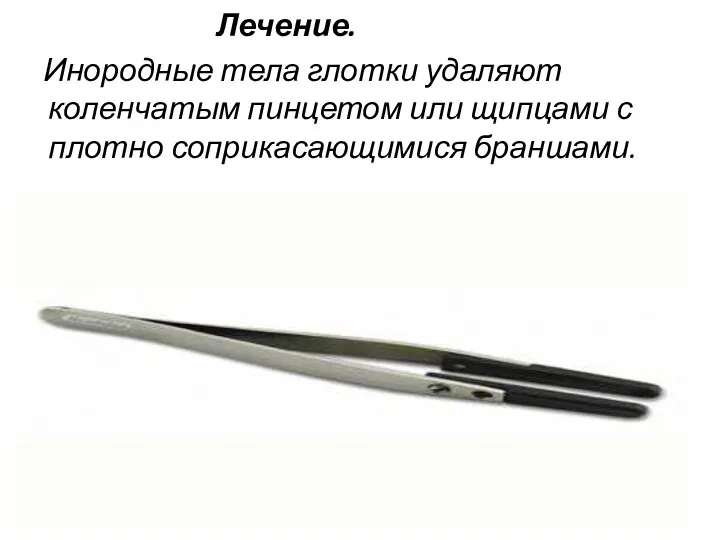 Лечение. Инородные тела глотки удаляют коленчатым пинцетом или щипцами с плотно соприкасающимися браншами.