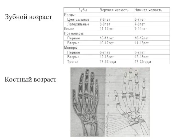Костный возраст Зубной возраст