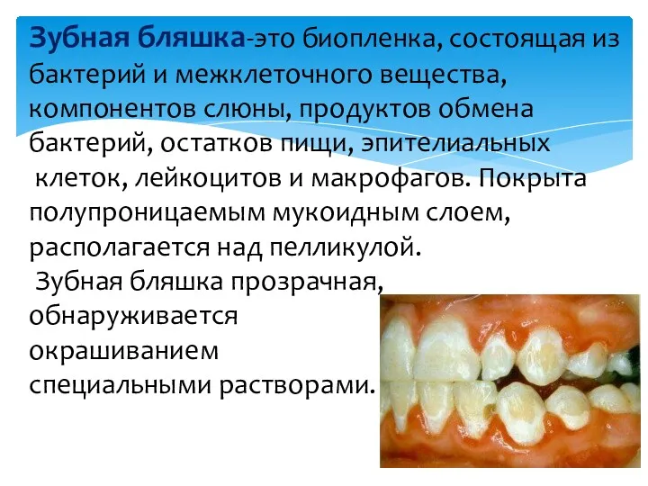 Зубная бляшка-это биопленка, состоящая из бактерий и межклеточного вещества, компонентов слюны, продуктов обмена