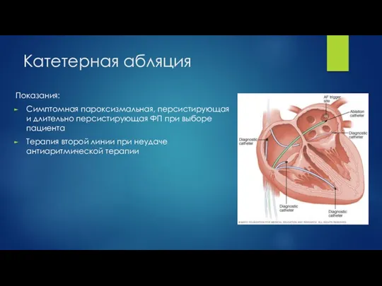 Катетерная абляция Показания: Симптомная пароксизмальная, персистирующая и длительно персистирующая ФП при выборе пациента