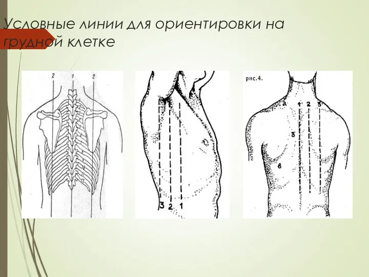 Условные линии для ориентировки на грудной клетке