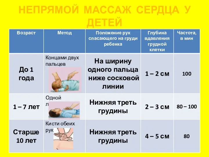 НЕПРЯМОЙ МАССАЖ СЕРДЦА У ДЕТЕЙ