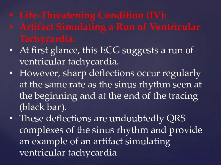 Life-Threatening Condition (IV): Artifact Simulating a Run of Ventricular Tachycardia.