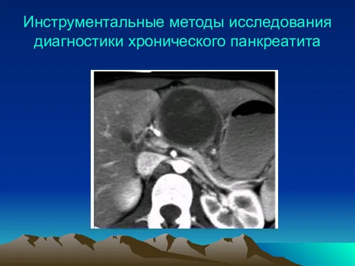 Инструментальные методы исследования диагностики хронического панкреатита