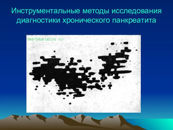 Инструментальные методы исследования диагностики хронического панкреатита