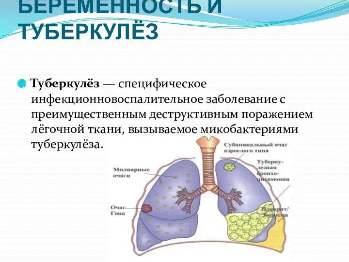 БЕРЕМЕННОСТЬ И ТУБЕРКУЛЁЗ Туберкулёз — специфическое инфекционновоспалительное заболевание с преимущественным