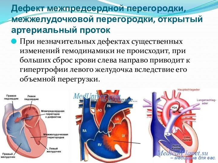 Дефект межпредсердной перегородки, межжелудочковой перегородки, открытый артериальный проток При незначительных