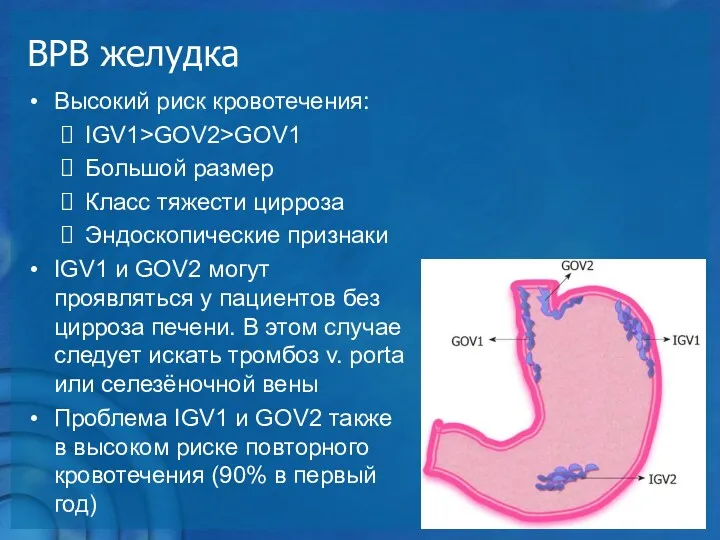 Высокий риск кровотечения: IGV1>GOV2>GOV1 Большой размер Класс тяжести цирроза Эндоскопические