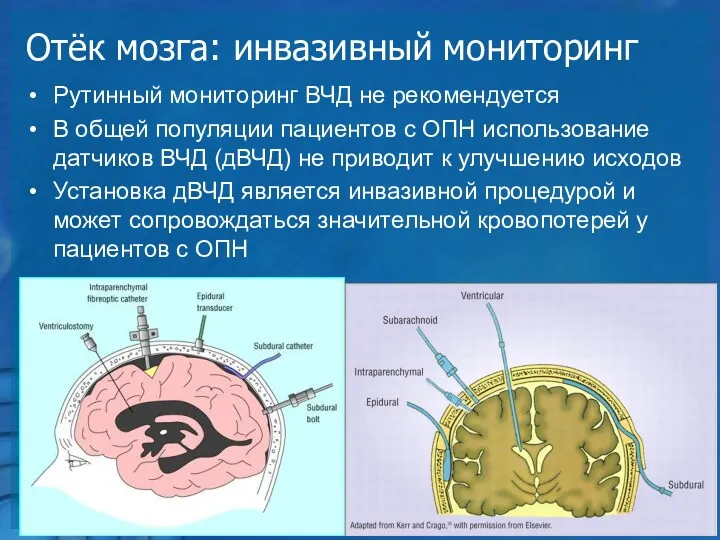 Отёк мозга: инвазивный мониторинг Рутинный мониторинг ВЧД не рекомендуется В